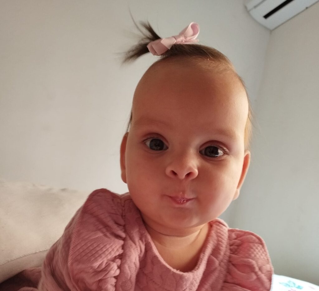 Cirurgia de Maria Cecília acontece neste fim de semana No mês de setembro a família realizou uma vaquinha online para custear viagem para cirurgia de correção do crânio da filha recém-nascida. Debora Castro A pequena Maria, diagnosticada com craniossinostose, realizará a cirurgia de correção neste sábado (28) em Montevideo, no Uruguai. De acordo com a mãe da Maria Cecília, Monalisa Antunes Mattoso, o procedimento fará a remodelação dos ossos do crânio para garantir o crescimento normal. “Nós conseguimos o peso e a doutora nos aconselhou esperar que ela completava 6 meses e assim conseguimos hoje a Maria está com 6 meses e 7,480kg e podemos fazer a cirurgia. Eles vão remodelar todo o ósseo do crânio para ele ter espaço para crescer, pois como ela está agora a tendência e crescer para frente e atrás”, explicou Monalisa, ressaltando que Maria Cecilia está se desenvolvimento normalmente. Monalisa agradece o apoio da comunidade santanense que colaborou com a vaquinha virtual permitindo que a família pudesse realizar todos os tramites para a cirurgia acontecer no país vizinho. Relembre a história A santanense Maria Cecília, com um mês de vida foi diagnosticada com uma anormalidade de fusão antecipada dos ossos do crânio chamada craniossinostose. De acordo com a mãe de Maria Cecília, Monalisa Antunes Mattoso, assim que nasceu, a filha foi diagnosticada com essa doença, caracterizada pelo fechamento precoce dos ossos do crânio, que resulta em deformidades no formato da cabeça. “Os médicos vão abrir esses ossos (do crânio) para que o cérebro possa crescer normalmente e assim modelar a cabeça dela. Não é uma questão de estética e sim que, da forma em que ele está, o cérebro ao crescer poderá provocar pressão craniana o que irá afetar a visão e o desenvolvimento dela futuramente”, explicou a mãe. Desse modo, os pais resolveram criar uma vaquinha online com o objetivo de arrecadar fundos para que possam se manter durante a cirurgia e pós-cirurgia do bebê, na capital uruguaia.